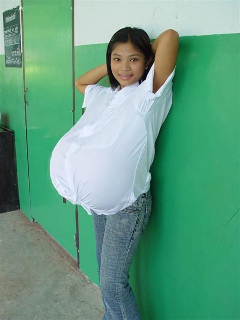 Asian woman with gigantomastia, gigantic breasts